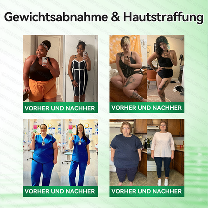 🇩🇪𝐎𝐟𝐟𝐢𝐳𝐢𝐞𝐥𝐥𝐞𝐫 𝐒𝐡𝐨𝐩 | 🩹👩‍⚕️ 𝑮𝑳𝑶𝐑𝐄𝐍𝐃𝘼® 𝑷𝒇𝒍𝒂𝒏𝒛𝒍𝒊𝒄𝒉𝒆𝒔 𝑷𝒇𝒍𝒆𝒈𝒆𝒌𝒐𝒏𝒛𝒆𝒑𝒕 𝒎𝒊𝒕 𝑲𝒐𝒎𝒑𝒍𝒆𝒙𝒇𝒐𝒓𝒎𝒆𝒍