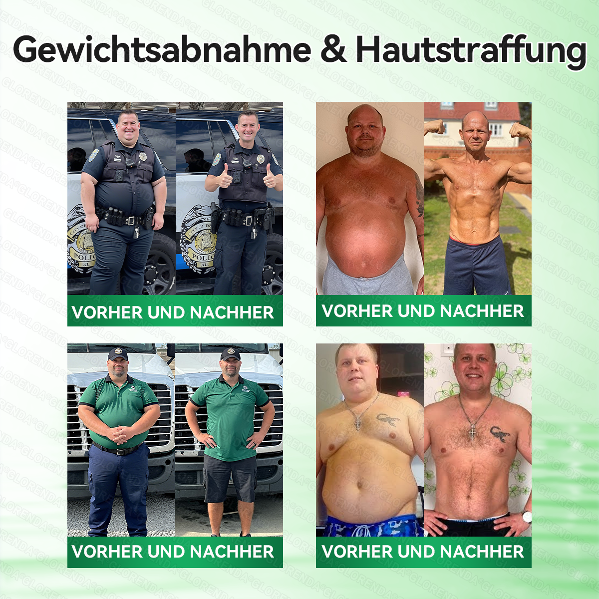 🇩🇪𝐎𝐟𝐟𝐢𝐳𝐢𝐞𝐥𝐥𝐞𝐫 𝐒𝐡𝐨𝐩 | 🩹👩‍⚕️ 𝑮𝑳𝑶𝐑𝐄𝐍𝐃𝘼® 𝑷𝒇𝒍𝒂𝒏𝒛𝒍𝒊𝒄𝒉𝒆𝒔 𝑷𝒇𝒍𝒆𝒈𝒆𝒌𝒐𝒏𝒛𝒆𝒑𝒕 𝒎𝒊𝒕 𝑲𝒐𝒎𝒑𝒍𝒆𝒙𝒇𝒐𝒓𝒎𝒆𝒍