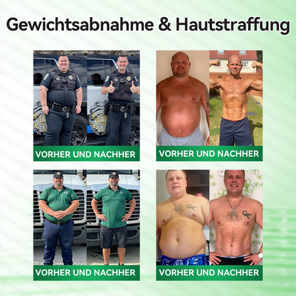 🇩🇪𝐎𝐟𝐟𝐢𝐳𝐢𝐞𝐥𝐥𝐞𝐫 𝐒𝐡𝐨𝐩 | 🩹👩‍⚕️ 𝑮𝑳𝑶𝐑𝐄𝐍𝐃𝘼® 𝑷𝒇𝒍𝒂𝒏𝒛𝒍𝒊𝒄𝒉𝒆𝒔 𝑷𝒇𝒍𝒆𝒈𝒆𝒌𝒐𝒏𝒛𝒆𝒑𝒕 𝒎𝒊𝒕 𝑲𝒐𝒎𝒑𝒍𝒆𝒙𝒇𝒐𝒓𝒎𝒆𝒍