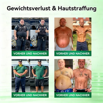 💪Neu eingetroffen💪 LUXARISE® Moringa Berberinex NAD+ 10-in-1 Nano-Mikronadel-Patch (Nur einmal täglich, sichtbare Veränderungen in 7 Tagen) ✅ Für Übergewicht, lockere Haut, Diabetes, Schlafapnoe, Gelenkprobleme und mehr